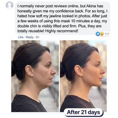 Double Chin Lifting Mask — 24K Gold & Collagen