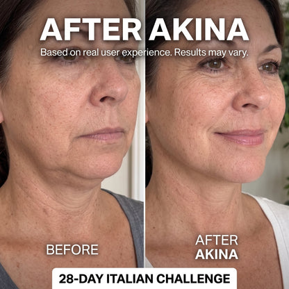 Double Chin Lifting Mask — 24K Gold & Collagen